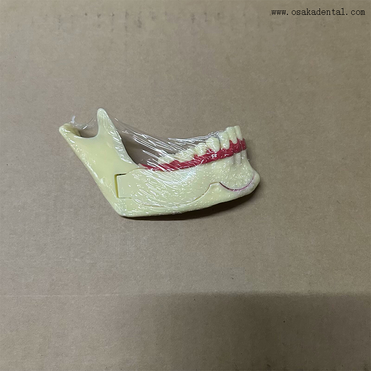 Mandibular decomposition model-1 Модель декомпозиции нижней челюсти-1