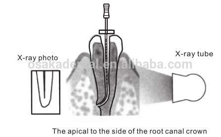 Высокая точность OSAKA Dental Apex Locator для корневого апекса