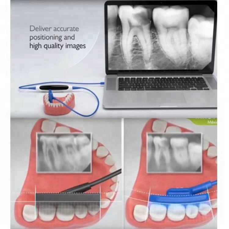 Новый корейский EZ цифровой стоматологический мягкий рентгеновский датчик