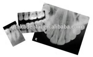 Горячая распродажа одобренный CE стоматологический рентгеновский пленочный процессор