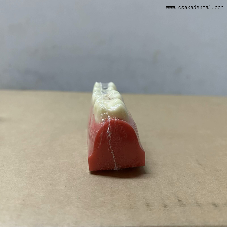 Демонстрационная модель герметика для зубных ям и фиссур 