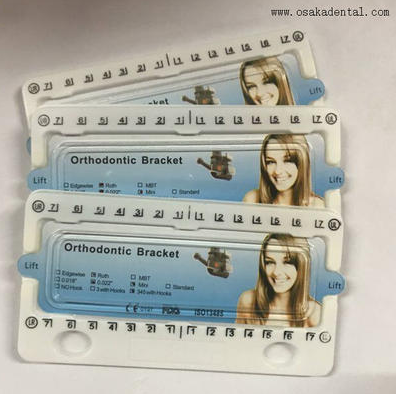 Что такое ортодонтическое лечение?