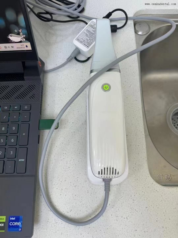 Профессиональный стоматологический 3D-сканер для лабораторий: высокоскоростная точность 15 мкм