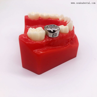 Стоматологические ортодонтические детские коронки из нержавеющей стали OSA-P30