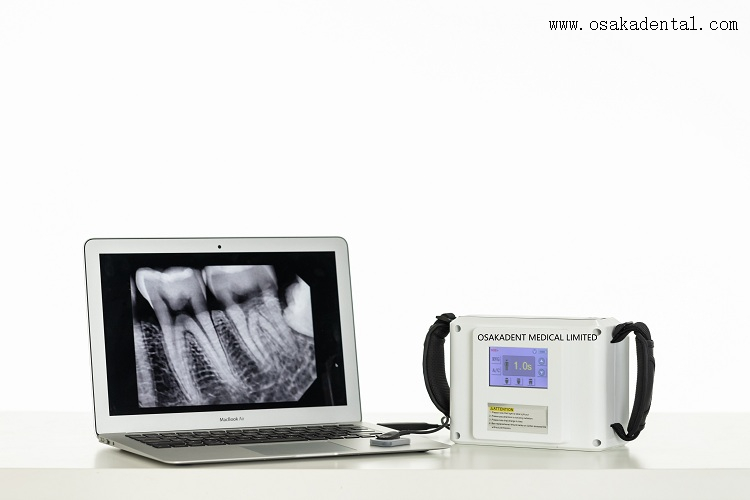 Хорошее качество стоматологический портативный рентгеновский аппарат OSA-F058E