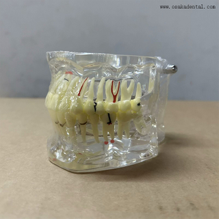 Модель патологии зубов для обучения стоматологов