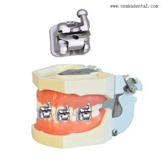 Стоматологическая ортодонтическая скоба Самоблокирующаяся скоба Стоматологическая самолигирующаяся скоба (лучшее качество)