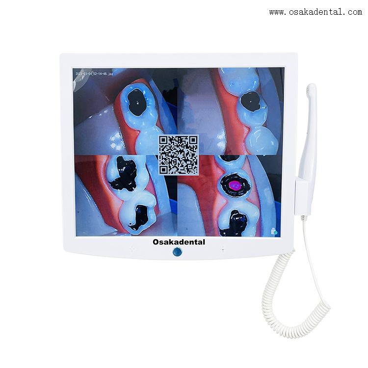 Монитор стоматологического кресла с оральной камерой
