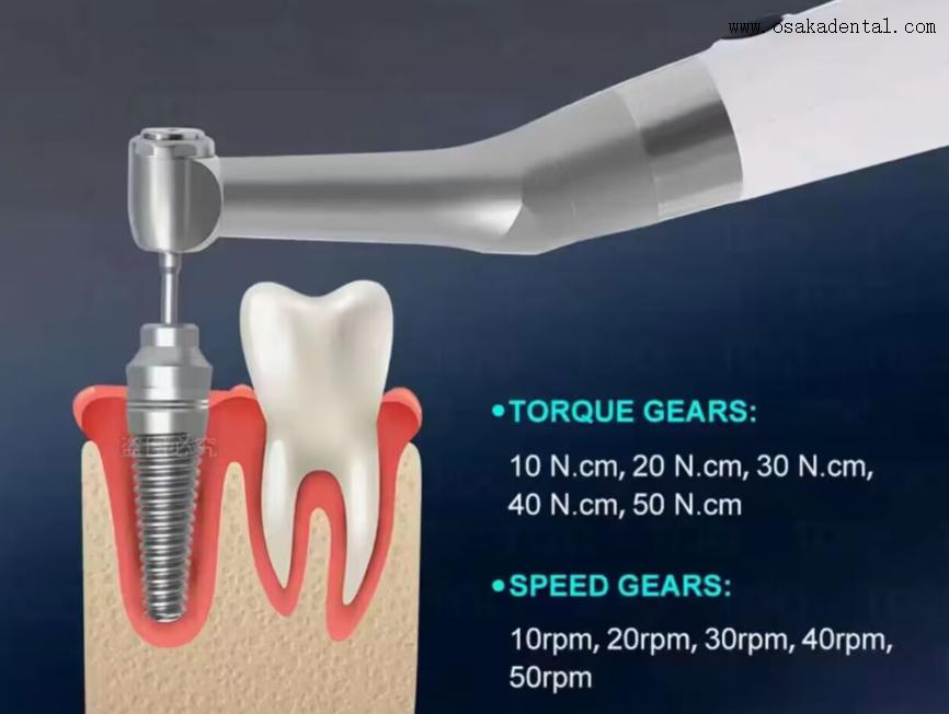 Стоматологический электрический ключ для имплантатов